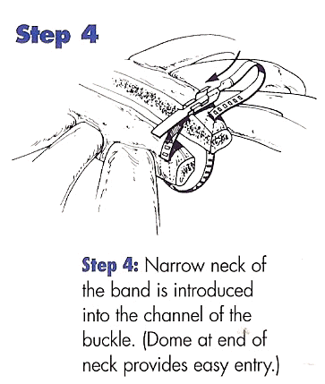 Step 4:  Sterna-band Instructions